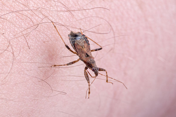 kissing bug on a person