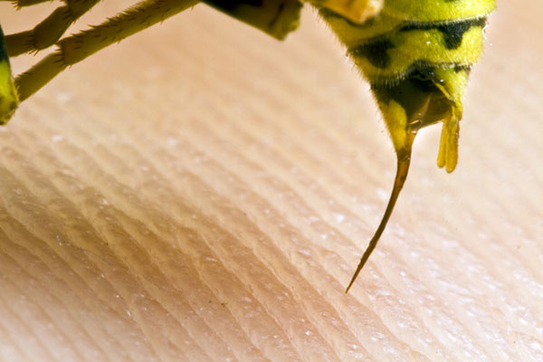 stinging-pests-pain